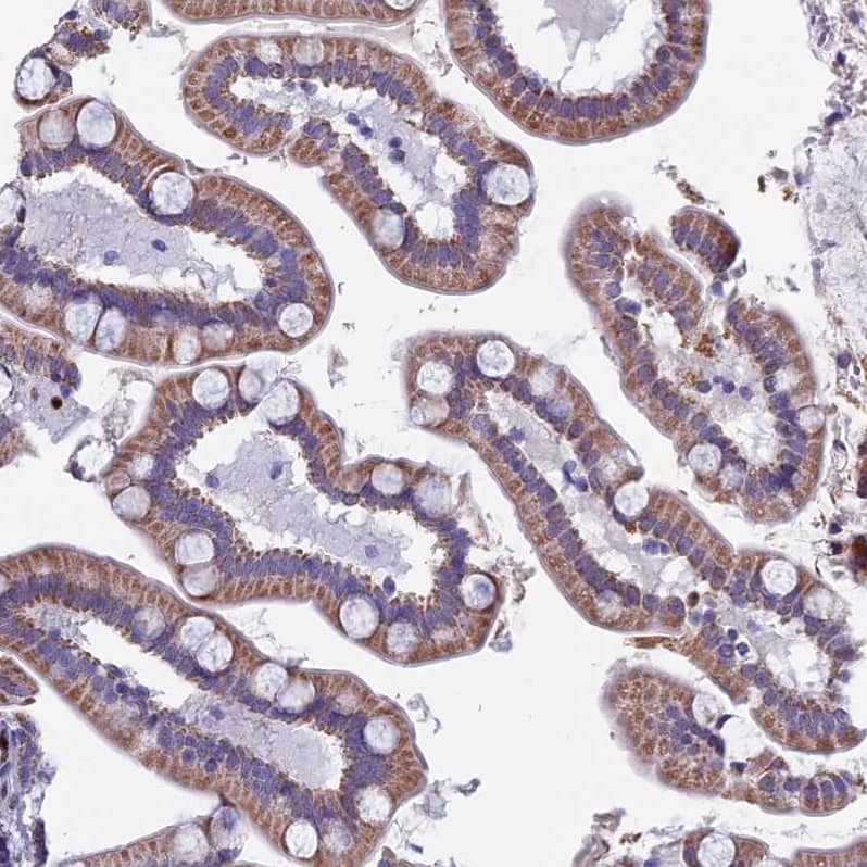 Staining of human small intestine shows moderate granular cytoplasmic positivity in glandular cells.