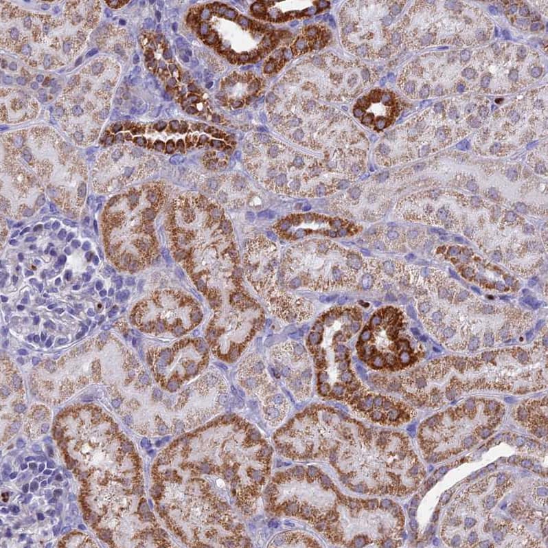 Staining of human kidney shows strong granular cytoplasmic positivity in cells in tubules.