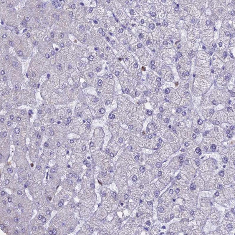 Staining of human liver shows no positivity in hepatocytes as expected.