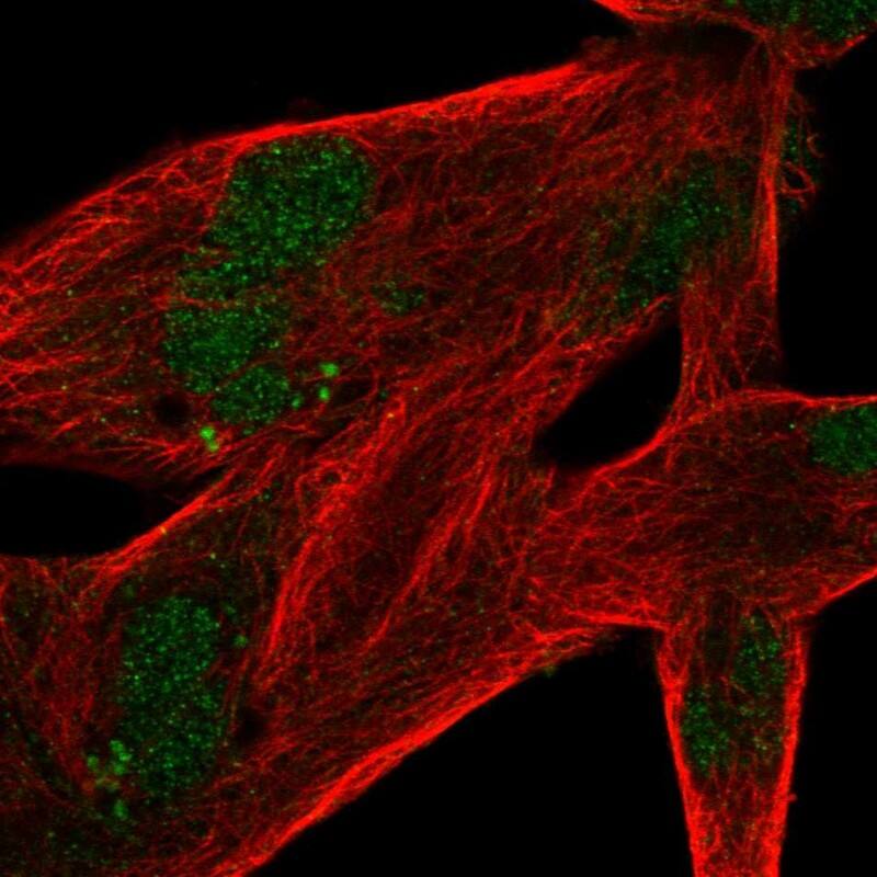 Staining of human cell line RH-30 shows localization to nucleus.