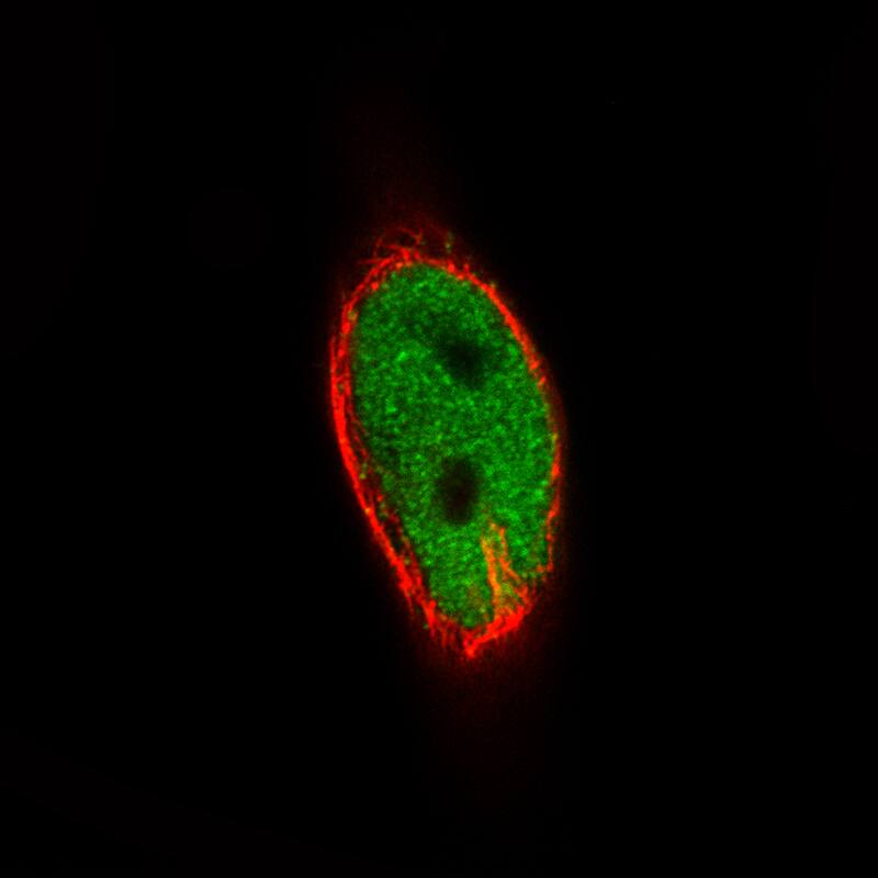 Staining of RH-30 cells, showing specific staining in the nucleoplasm in green. Microtubule- and nuclear probes are visualized in red and blue, respectively (where available).