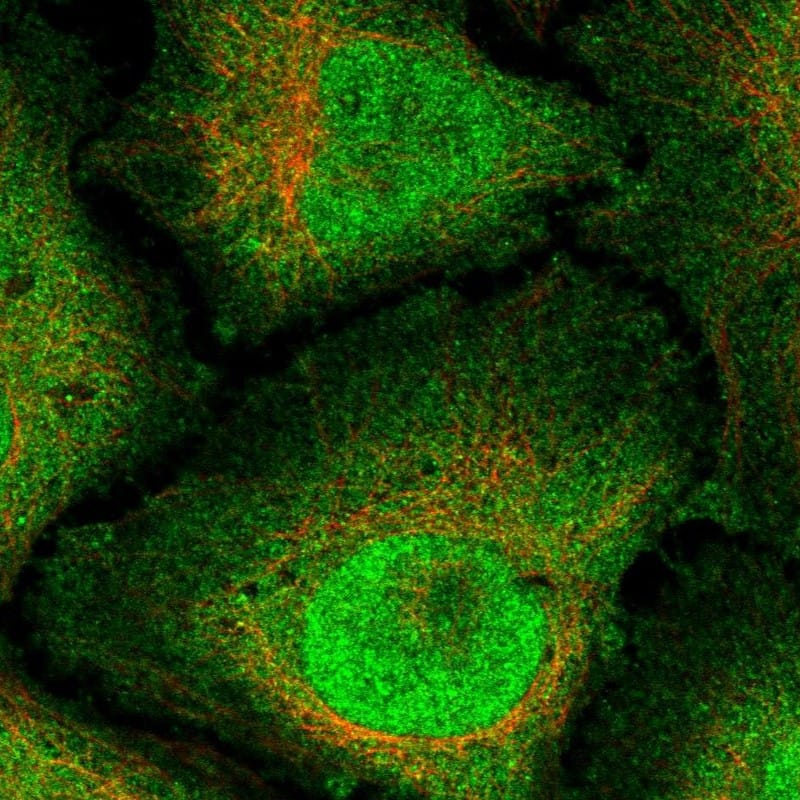 Staining of human cell line HeLa shows localization to nucleus & plasma membrane.