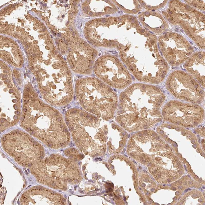 Staining of human kidney shows moderate granular cytoplasmic positivity in cells in tubules.