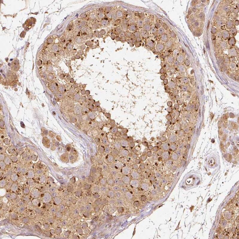 Staining of human testis shows moderate granular cytoplasmic positivity in cells in seminiferous ducts.