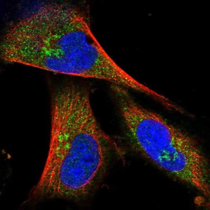 Immunocytochemistry/ Immunofluorescence COG4 Antibody - BSA Free