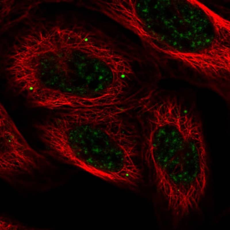 Staining of human cell line U-2 OS shows localization to nuclear speckles & vesicles.