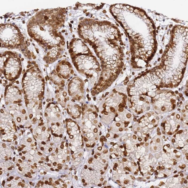 Immunohistochemistry-Paraffin C6orf141 Antibody - BSA Free
