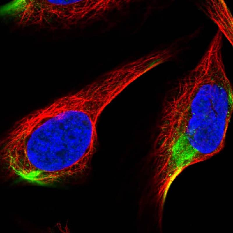 Staining of human cell line U-2 OS shows localization to intermediate filaments.
