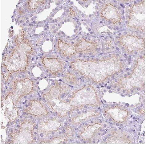  MFSD3 Antibody [NBP2-30815] -Staining of human kidney shows moderate membranous positivity in cells in tubules.