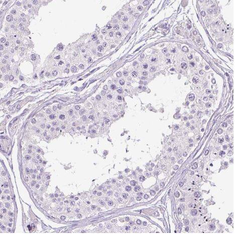  MFSD3 Antibody [NBP2-30815] -Staining of human testis shows no positivity in cells in seminiferous ducts as expected.