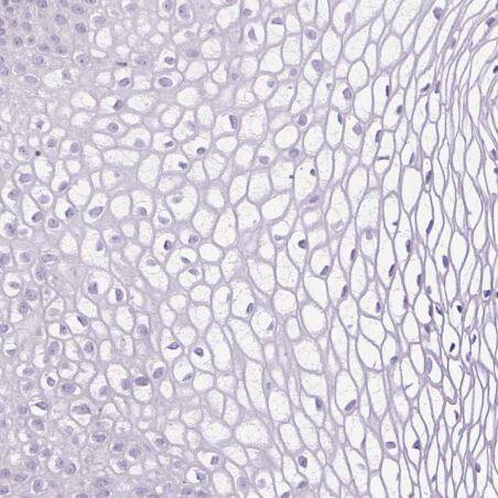 MFSD3 Antibody [NBP2-30815] -Staining of human cervix, uterine shows no positivity in squamous epithelial cells as expected.