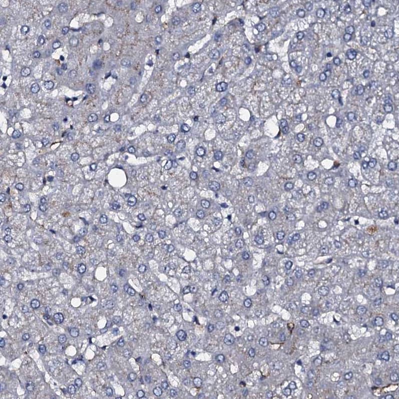 Staining of human liver shows low positivity in hepatocytes as expected.