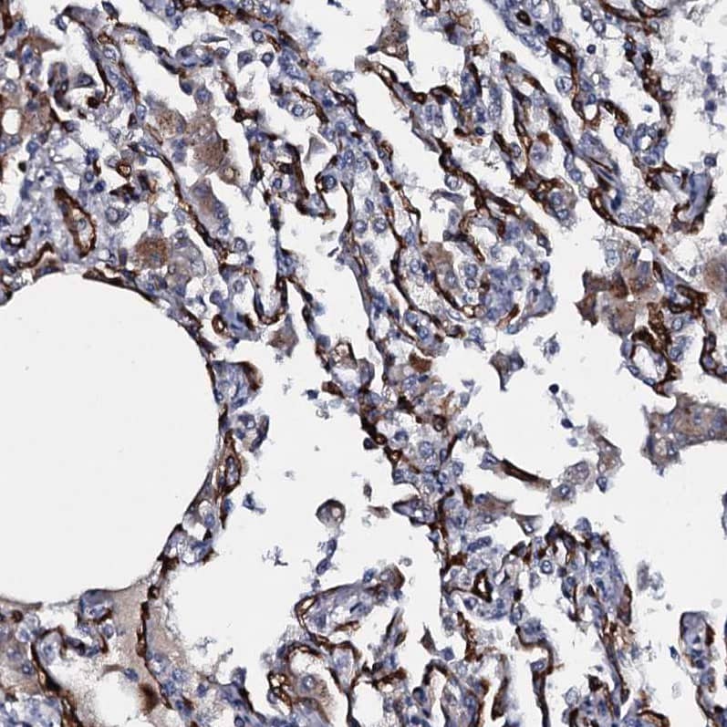 Staining of human lung shows strong membranous positivity in respiratory epithelial cells.