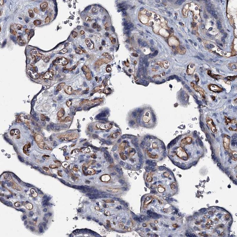 Staining of human placenta shows moderate to strong membranous positivity in endothelial cells.