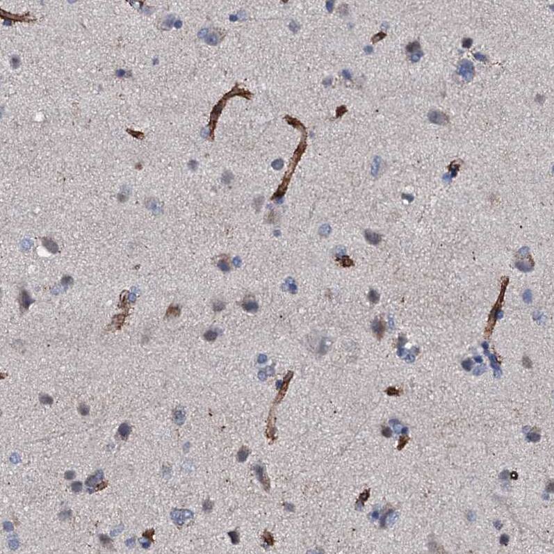 Staining of human cerebral cortex shows strong membranous positivity in endothelial cells.