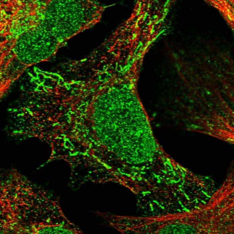 Immunocytochemistry/ Immunofluorescence Trinucleotide Repeat Containing 18 Antibody - BSA Free