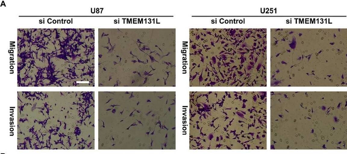 Decreased migration and invasive ability of U87 and U251 after interference with TMEM131L. (A,E,F) After interference with TMEM131L, the migratory and invasive capacity of U87 and U251 was decreased and cell numbers were quantified (n = 3); (B,G) After interfering with TMEM131L, the invasive ability of U87 and U251 was decreased and quantified for wounds (n = 3); (C,D,H) Prolonged cell cycle of U87 and U251 after interference with TMEM131L expression (n = 3). **p ≤ 0.01, ***p ≤ 0.001, and ****p ≤ 0.0001. Image collected and cropped by CiteAb from the following open publication (//pubmed.ncbi.nlm.nih.gov/37090987), licensed under a CC-BY license. Not internally tested by Novus Biologicals.