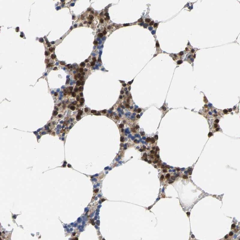 Staining of human bone marrow shows strong positivity in a subset of hematopoietic cells.