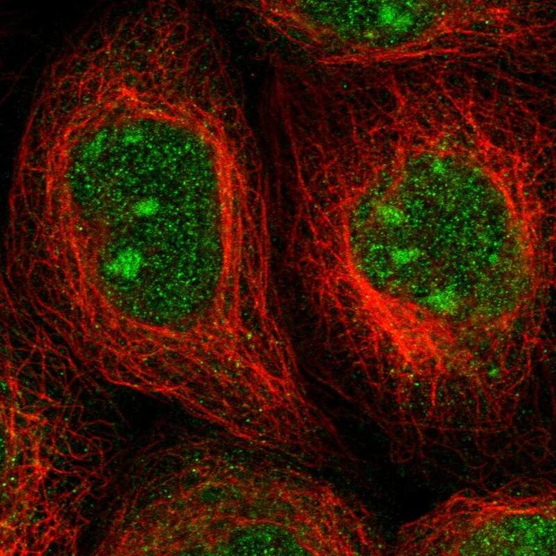Staining of human cell line A-431 shows localization to nucleus & nucleoli.