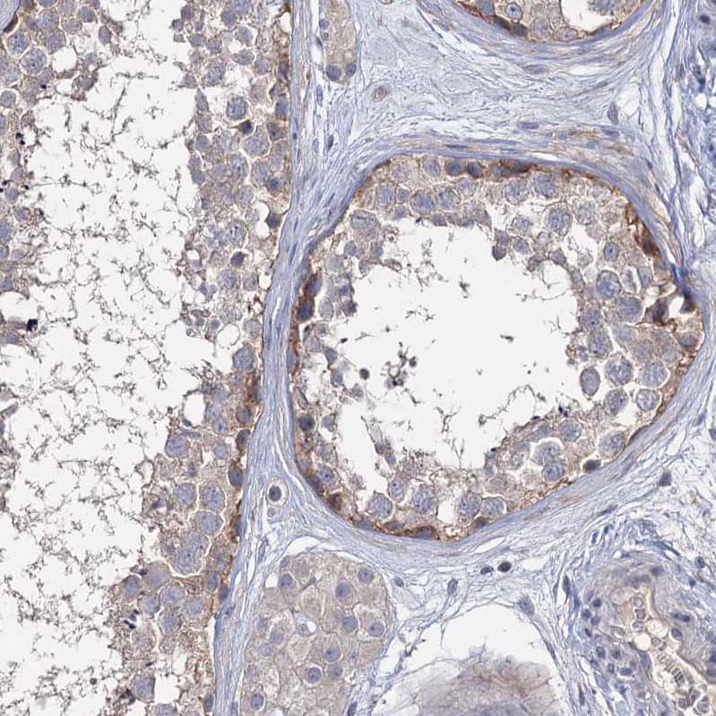 Staining of human testis shows weak cytoplasmic positivity in spermatogonia.