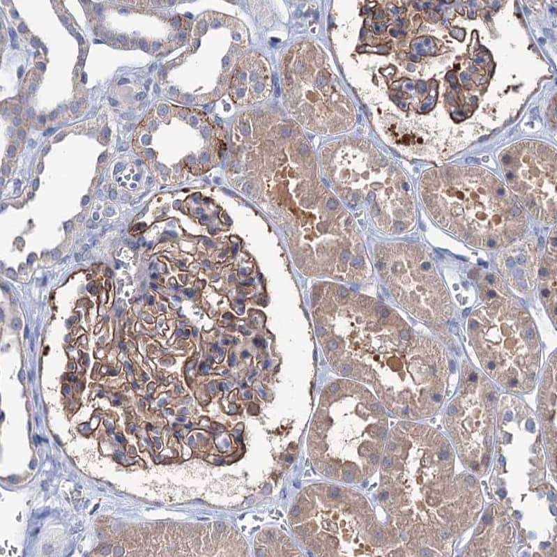 Staining of human kidney shows strong membranous positivity in cells in glomeruli.
