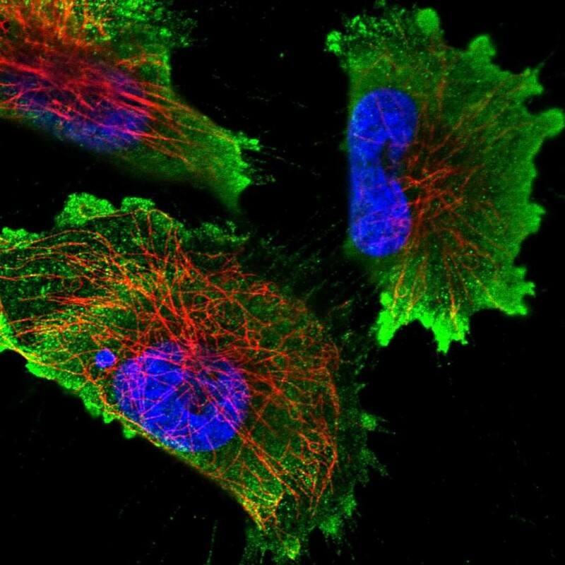 Immunocytochemistry/ Immunofluorescence N6AMT2 Antibody - BSA Free