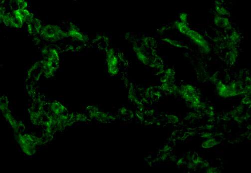 Immunocytochemistry/ Immunofluorescence: TRIF/TICAM1 Antibody - BSA Free [NBP2-31189] - Immunofluorescence of TRIF/TICAM1 in Human Lung cells with TRIF/TICAM1 antibody at 10 ug/mL.