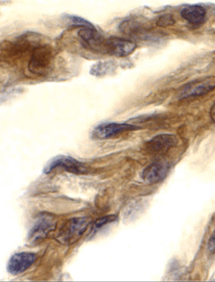 Immunohistochemistry: TRIF/TICAM1 Antibody - BSA Free [NBP2-31189] - Immunohistochemistry of TRIF/TICAM1 in human lung tissue with TRIF/TICAM1 antibody at 10 u/mL.