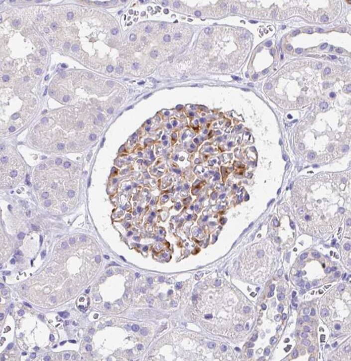 Staining of human kidney shows strong cytoplasmic positivity in cells in glomeruli.