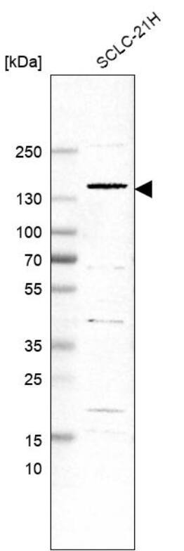 Analysis in human cell line SCLC-21H.
