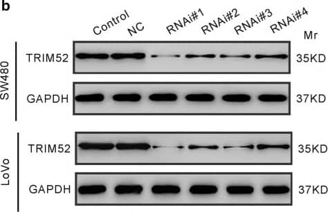 Western Blot: TRIM52 Antibody [NBP2-31651] - Knockdown of TRIM52 suppresses cell proliferation of CRC cells. a Protein expression of TRIM52 in HIEC cell line & 5 CRC cell lines. GAPDH was served as the loading control. b SW480 & LoVo cells were transduced with with lentivirus expressing shRNAs against TRIM52 (RNAi#1, #2, #3 or #4) or with control shRNA (NC) for 48 h. TRIM52 protein expression was analyzed by immunoblot assay. Cells without any treatment were served as negative control. c CCK-8 assays were performed to assess cell proliferation of SW480 & LoVo cells transduced with indicated virus for 0, 24, 48 or 72 h. *p < 0.05, **p < 0.01, ***p < 0.001 vs. NC cells Image collected & cropped by CiteAb from the following publication (//pubmed.ncbi.nlm.nih.gov/30918473), licensed under a CC-BY license. Not internally tested by Novus Biologicals.