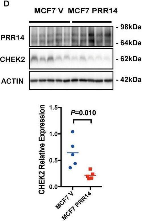 PRR14 inhibits CHEK2.CHEK2 mRNA expression (a), CHEK2 protein expression (b) and p-CHEK2 (T68) protein expression (c) in PRR14 genetically unaltered and altered (amplified and mutated) breast cancer cases in TCGA database are statistically analyzed by two-tailed Student’s t-test. CHEK2 protein expression is detected by immunostaining in xenografts in nude mice from established MCF7 cell lines and MDA-MB-231 cell lines (d), as well as human breast cancer (e). CHEK2 transcription in human breast cancer is also detected by qRT-PCR (f). The data are quantified and two-tailed Student’s t-test is employed to determine the significance of the difference. Established MCF7 and MDA-MB-231 (g) PRR14-overexpressing and control cell lines are treated with various of genotoxic chemicals including Bleo, Eto, 5-FU, H2O2 and HU at indicated concentrations for indicated time. Key components of the ATM/CHEK2/P53 signaling pathway are detected by immunostaining. And CHEK2 protein expression (h) and mRNA expression (i) are detected by immunostaining and qRT-PCR, respectively. The data are analyzed by two-tailed Student’s t-test. Established MCF7 and MDA-MB-231 (j) PRR14-overexpressing and control cell lines are treated with Eto at indicated concentration for indicated time to induce p-CHEK2 (T68), which is detected by immunostaining and quantified and normalized by CHEK2 total protein (k). The data are analyzed by two-tailed Student’s t-test. Image collected and cropped by CiteAb from the following open publication (//pubmed.ncbi.nlm.nih.gov/32541902), licensed under a CC-BY license. Not internally tested by Novus Biologicals.