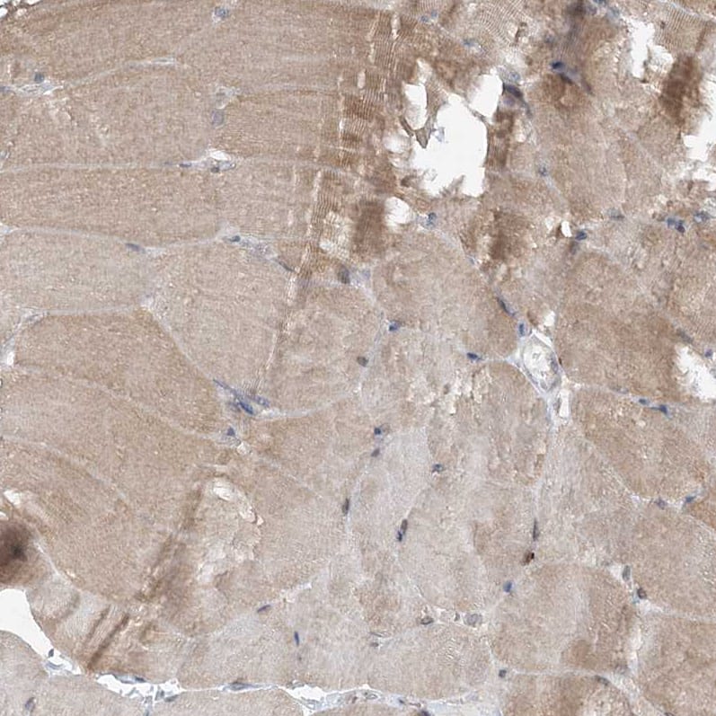 Staining of human skeletal muscle shows moderate cytoplasmic positivity in myocytes.