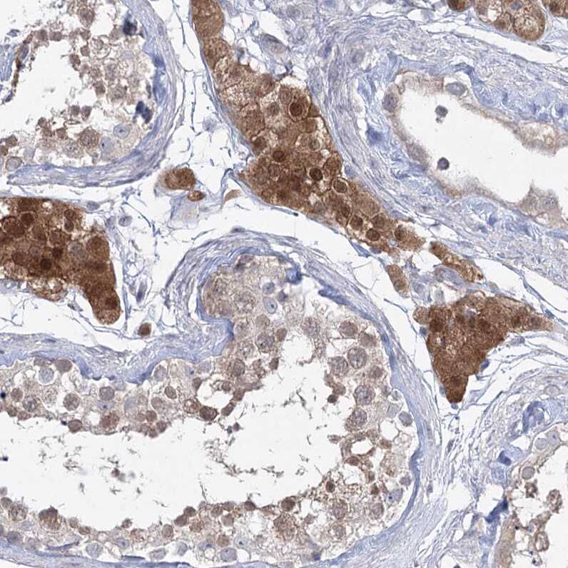 Staining of human testis shows strong cytoplasmic positivity in Leydig cells.
