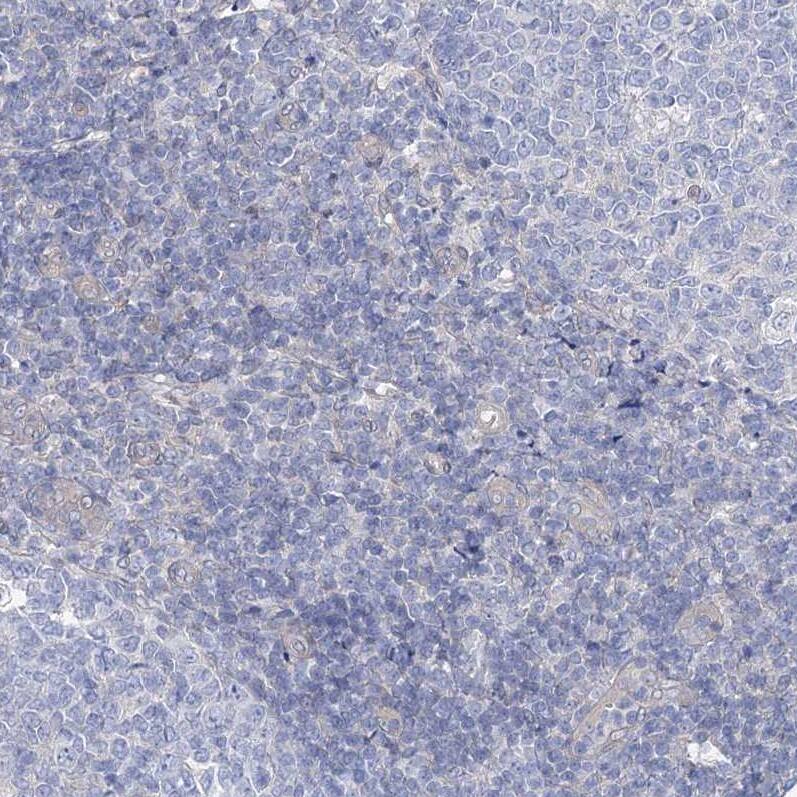 Staining of human tonsil shows no positivity in non-germinal center cells as expected.