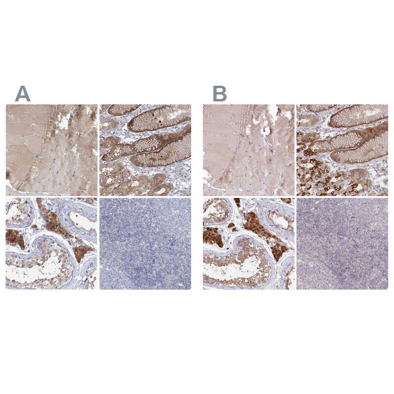 <b>Orthogonal Strategies Validation. </b>Staining of human skeletal muscle, stomach, testis and tonsil HPA037919 (A) shows similar protein distribution across tissues to independent antibody HPA037918 (B).
