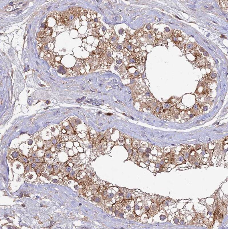 Immunohistochemistry-Paraffin DENND5B Antibody - BSA Free