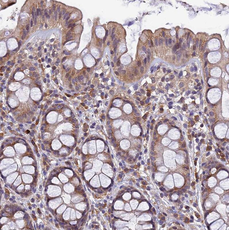 Immunohistochemistry-Paraffin DENND5B Antibody - BSA Free