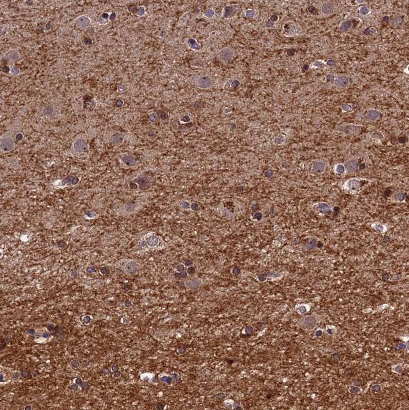 Immunohistochemistry-Paraffin DENND5B Antibody - BSA Free