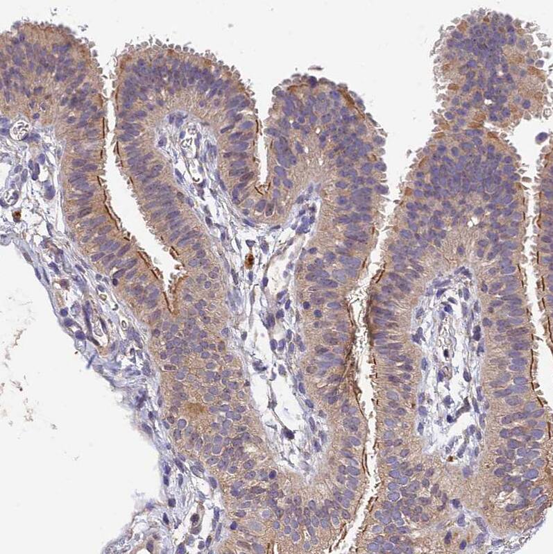 Immunohistochemistry-Paraffin DENND5B Antibody - BSA Free