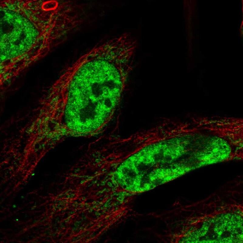 Immunocytochemistry/ Immunofluorescence CWC15 Antibody - BSA Free