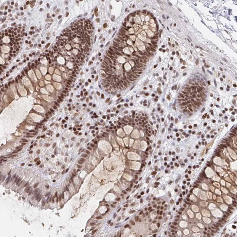 Immunohistochemistry-Paraffin H1FX Antibody - BSA Free