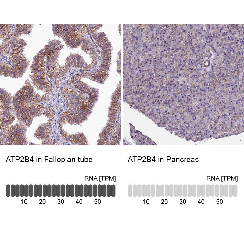 <b>Orthogonal Strategies Validation. </b>Analysis in human fallopian tube and pancreas tissues.