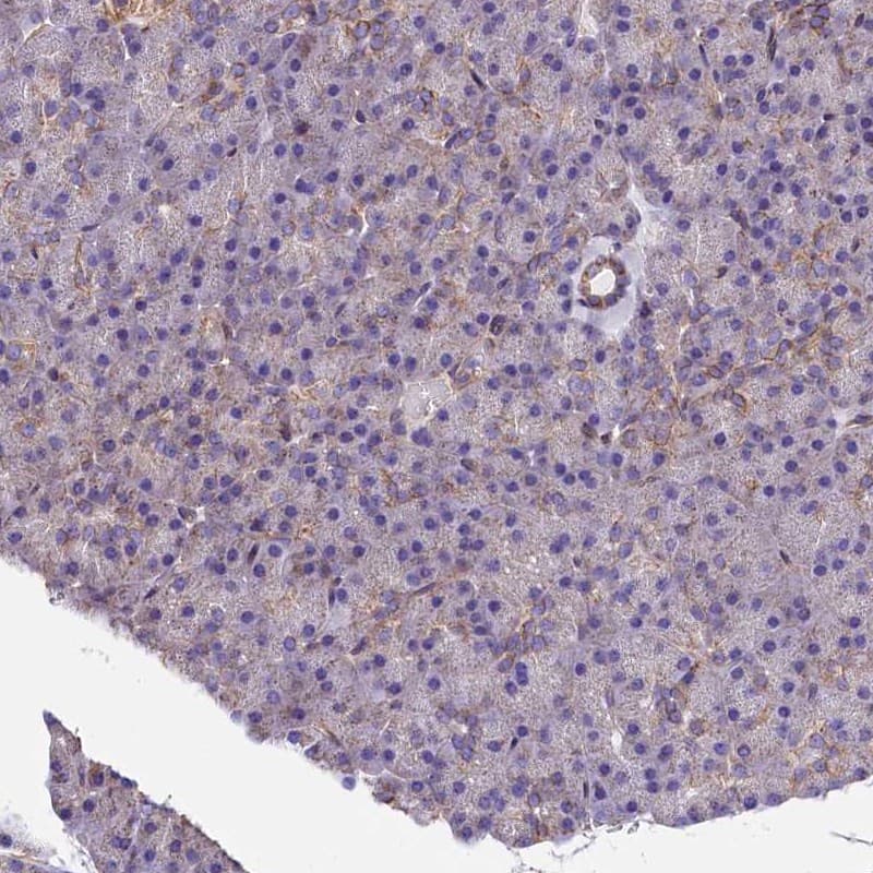 Staining of human pancreas shows low expression as expected.