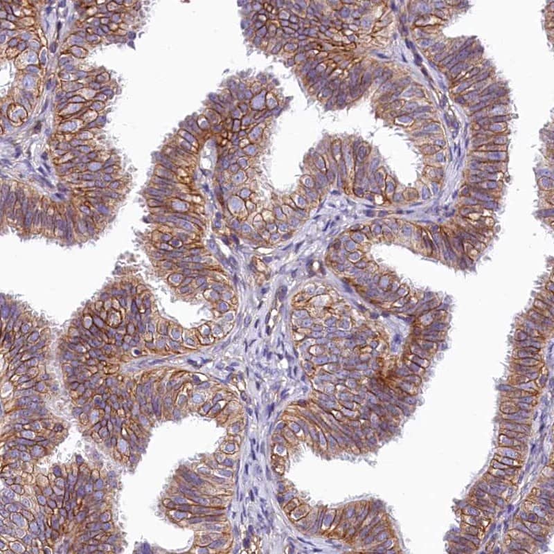 Staining of human fallopian tube shows high expression.