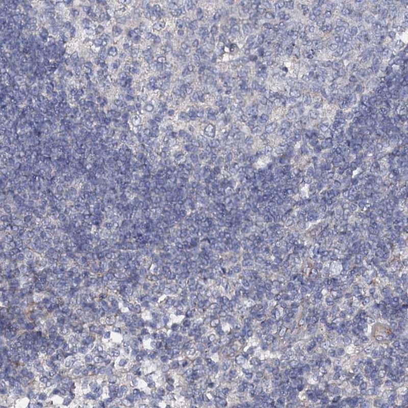 Immunohistochemistry-Paraffin Glucuronic Acid Epimerase Antibody - BSA Free