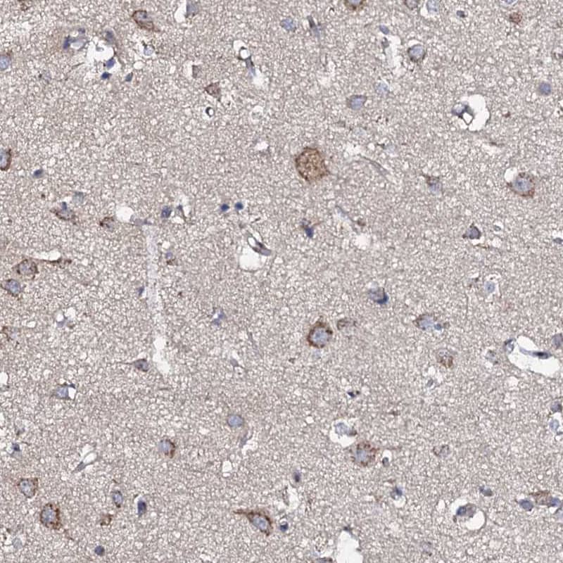 Staining of human cerebral cortex shows moderate cytoplasmic positivity in neurons.