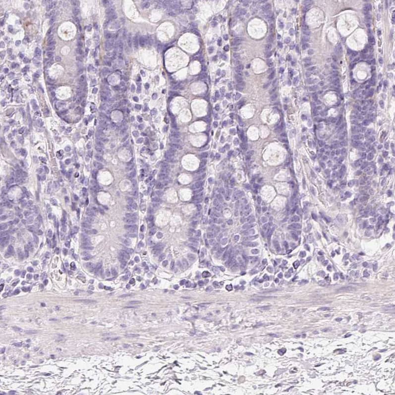 Staining of human duodenum shows no positivity in glandular cells as expected.