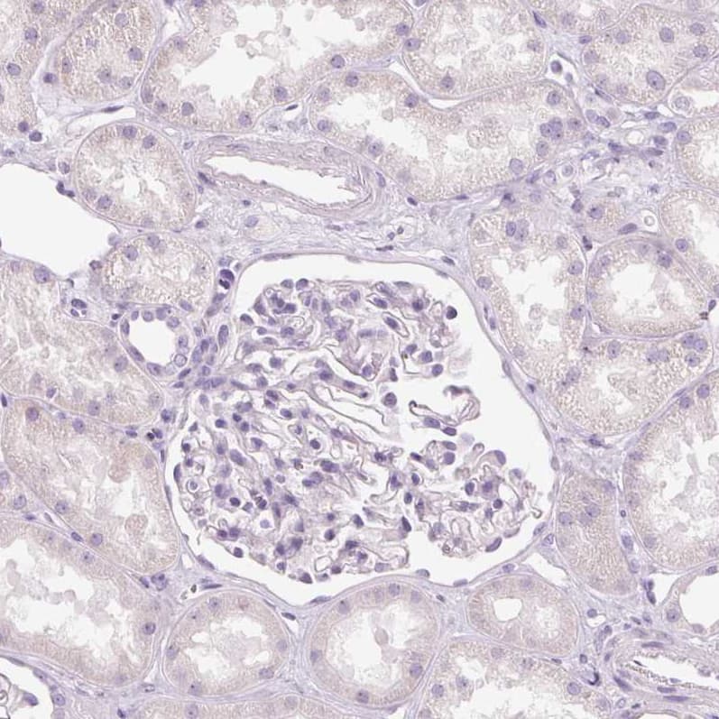 Staining of human kidney shows no positivity as expected.