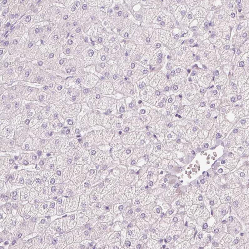 Staining of human liver shows no positivity in hepatocytes as expected.
